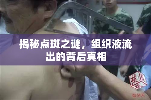 揭秘點斑之謎，組織液流出的背后真相