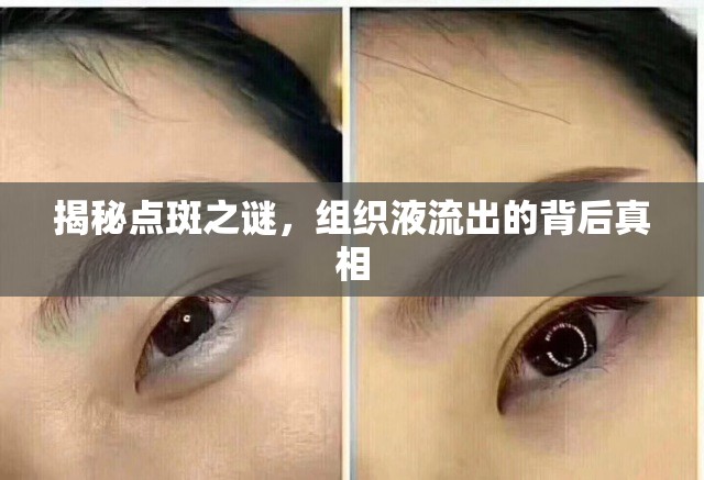 揭秘點斑之謎，組織液流出的背后真相