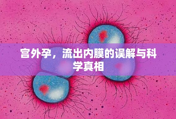 宮外孕，流出內(nèi)膜的誤解與科學(xué)真相