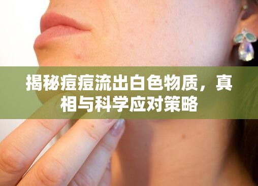 揭秘痘痘流出白色物質(zhì)，真相與科學(xué)應(yīng)對策略