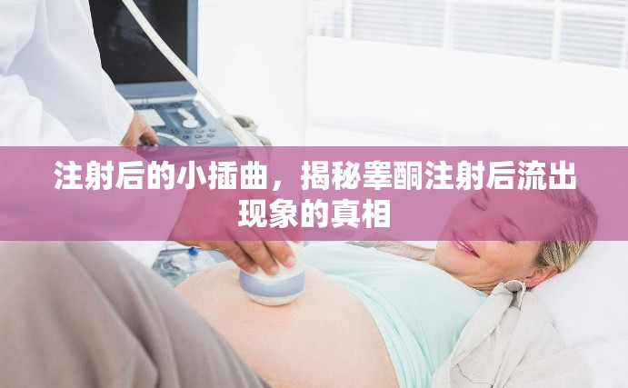 注射后的小插曲，揭秘睪酮注射后流出現(xiàn)象的真相