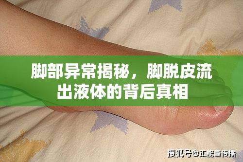 腳部異常揭秘，腳脫皮流出液體的背后真相