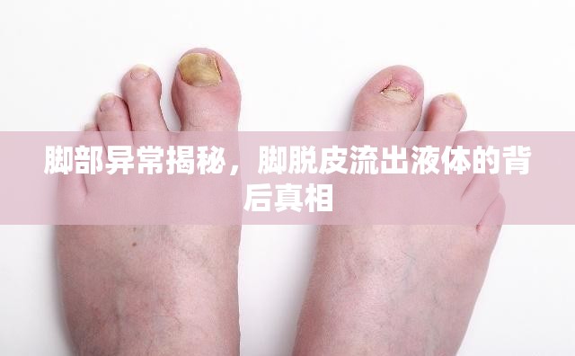 腳部異常揭秘，腳脫皮流出液體的背后真相