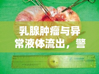 乳腺腫瘤與異常液體流出，警覺的信號與科學(xué)應(yīng)對策略