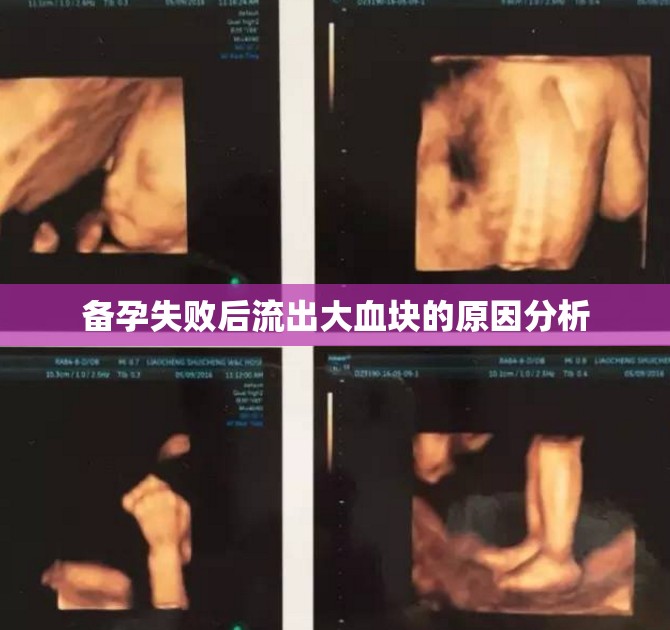 備孕失敗后流出大血塊的原因分析