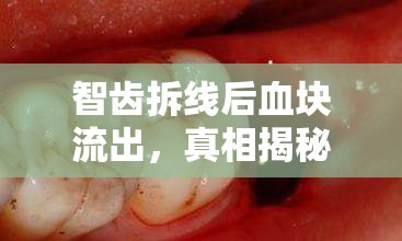 智齒拆線(xiàn)后血塊流出，真相揭秘與應(yīng)對(duì)策略