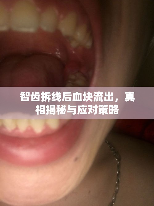智齒拆線(xiàn)后血塊流出，真相揭秘與應(yīng)對(duì)策略