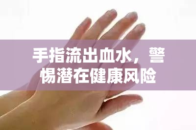 手指流出血水，警惕潛在健康風(fēng)險(xiǎn)