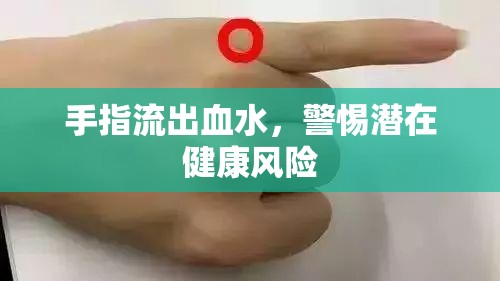 手指流出血水，警惕潛在健康風(fēng)險(xiǎn)