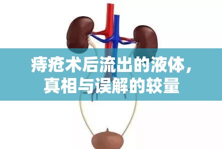 痔瘡術后流出的液體，真相與誤解的較量