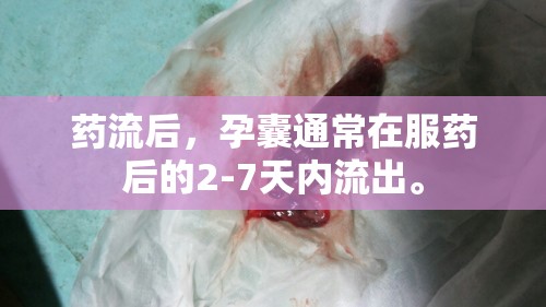 藥流后，孕囊通常在服藥后的2-7天內(nèi)流出。