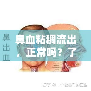 鼻血粘稠流出，正常嗎？了解背后的真相