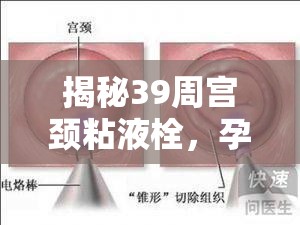 揭秘39周宮頸粘液栓，孕期里程碑的信號(hào)