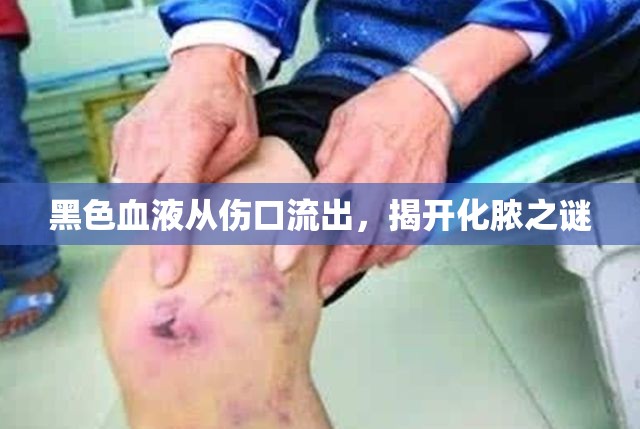 黑色血液從傷口流出，揭開化膿之謎