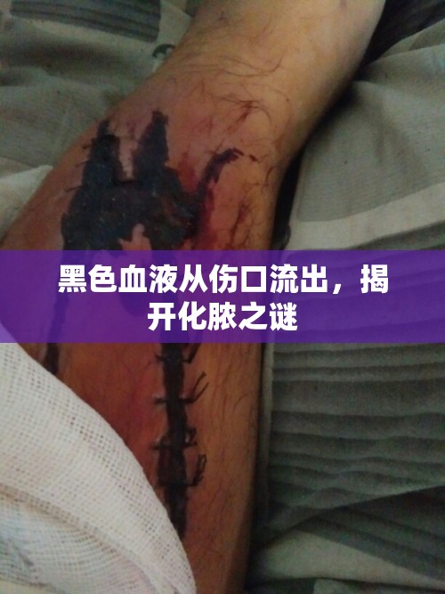 黑色血液從傷口流出，揭開化膿之謎