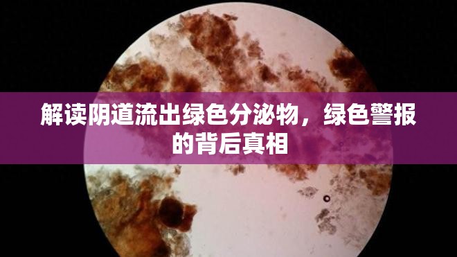 解讀陰道流出綠色分泌物，綠色警報的背后真相