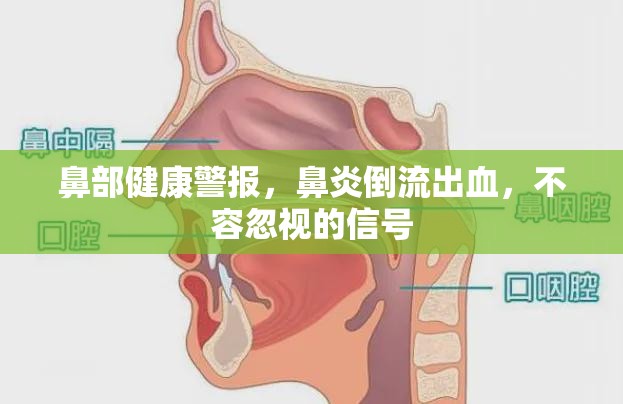 鼻部健康警報，鼻炎倒流出血，不容忽視的信號