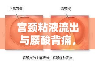 宮頸粘液流出與腰酸背痛，女性健康的隱形信號