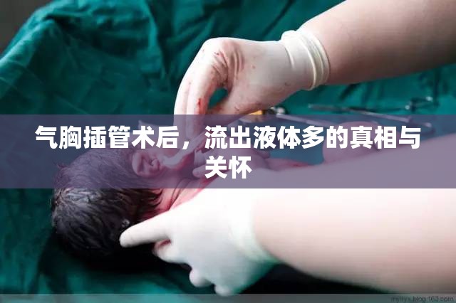 氣胸插管術后，流出液體多的真相與關懷