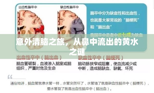 意外清腦之旅，從鼻中流出的黃水之謎