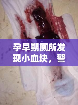 孕早期廁所發(fā)現(xiàn)小血塊，警惕先兆流產(chǎn)的信號