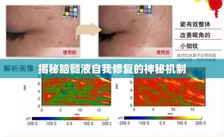 揭秘腦髓液自我修復(fù)的神秘機(jī)制