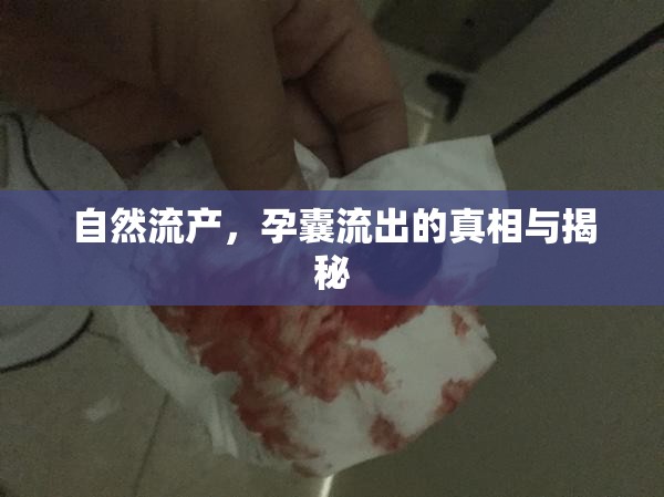 自然流產，孕囊流出的真相與揭秘