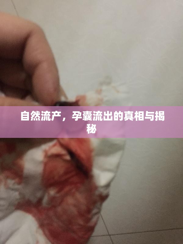 自然流產，孕囊流出的真相與揭秘