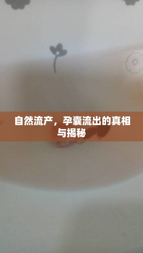 自然流產，孕囊流出的真相與揭秘