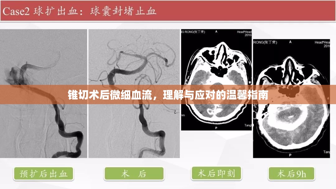 錐切術(shù)后微細血流，理解與應(yīng)對的溫馨指南