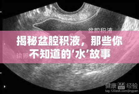 揭秘盆腔積液，那些你不知道的‘水’故事