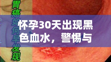 懷孕30天出現(xiàn)黑色血水，警惕與應(yīng)對(duì)的全面指南