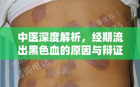 中醫(yī)深度解析，經(jīng)期流出黑色血的原因與辯證治療