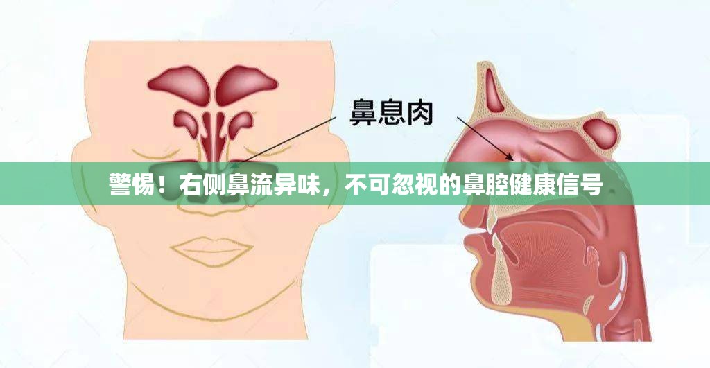 警惕！右側(cè)鼻流異味，不可忽視的鼻腔健康信號