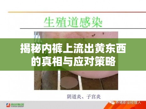 揭秘內(nèi)褲上流出黃東西的真相與應(yīng)對(duì)策略