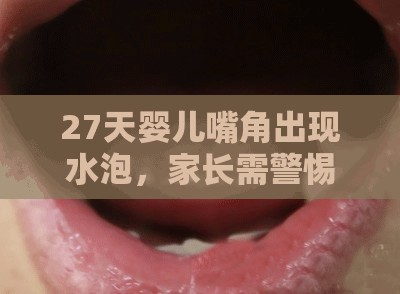 27天嬰兒嘴角出現(xiàn)水泡，家長(zhǎng)需警惕的早期癥狀