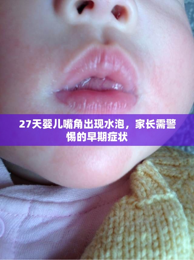 27天嬰兒嘴角出現(xiàn)水泡，家長(zhǎng)需警惕的早期癥狀