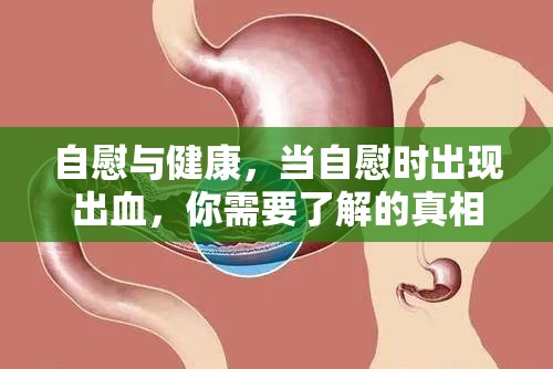 自慰與健康，當(dāng)自慰時出現(xiàn)出血，你需要了解的真相