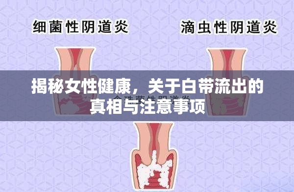 揭秘女性健康，關于白帶流出的真相與注意事項