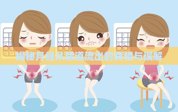 揭秘月經(jīng)從尿道流出的真相與誤解