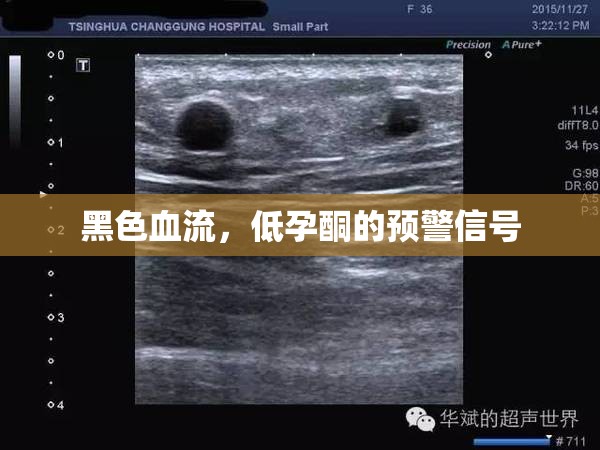 黑色血流，低孕酮的預警信號