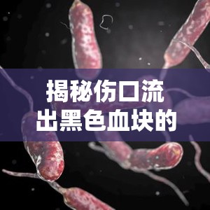 揭秘傷口流出黑色血塊的真相