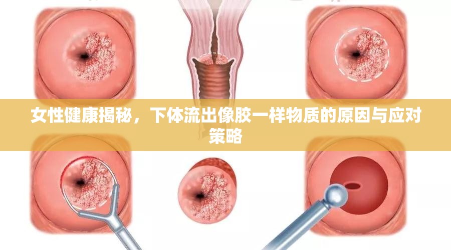 女性健康揭秘，下體流出像膠一樣物質(zhì)的原因與應對策略