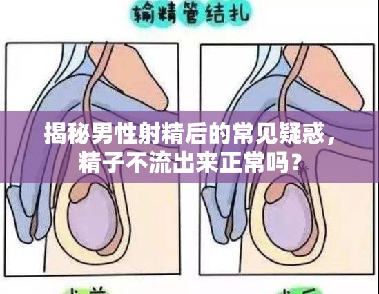 揭秘男性射精后的常見疑惑，精子不流出來正常嗎？