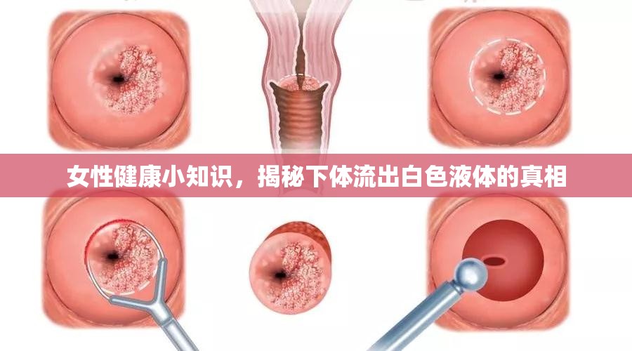 女性健康小知識，揭秘下體流出白色液體的真相