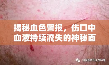 揭秘血色警報，傷口中血液持續(xù)流失的神秘面紗