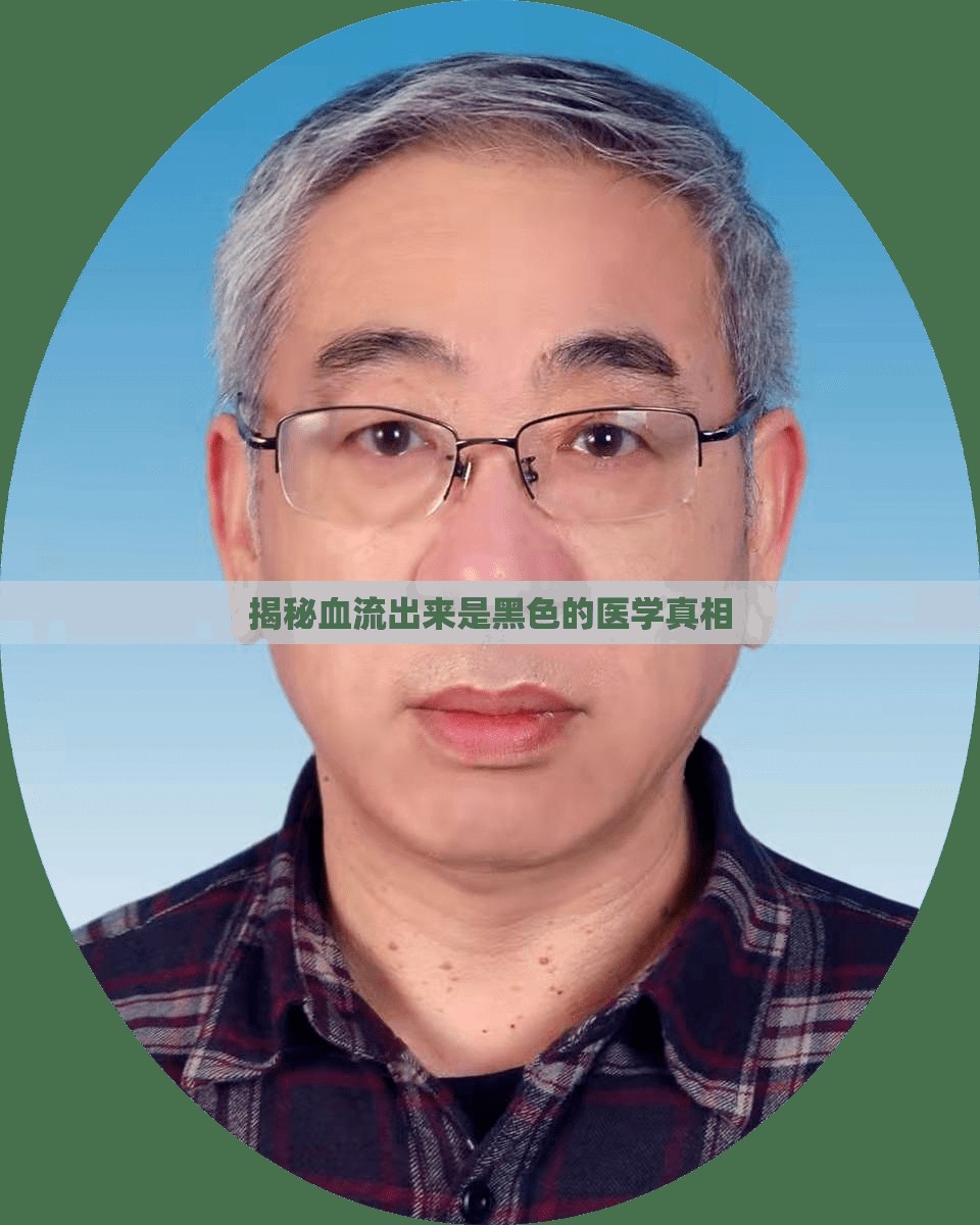 揭秘血流出來是黑色的醫(yī)學(xué)真相
