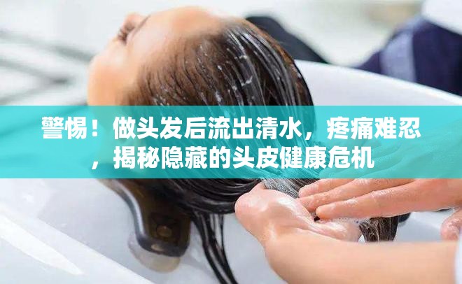 警惕！做頭發(fā)后流出清水，疼痛難忍，揭秘隱藏的頭皮健康危機(jī)