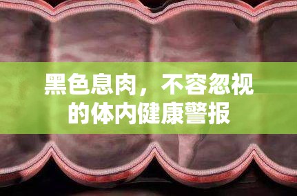 黑色息肉，不容忽視的體內(nèi)健康警報(bào)