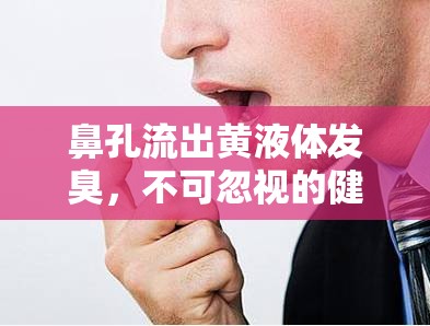 鼻孔流出黃液體發(fā)臭，不可忽視的健康警報